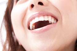 ［画像］キレイな歯が、予防意識を高めます