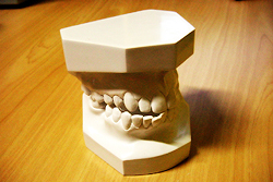 ［画像］認知症予防のためにも、歯を失わないことが大切です